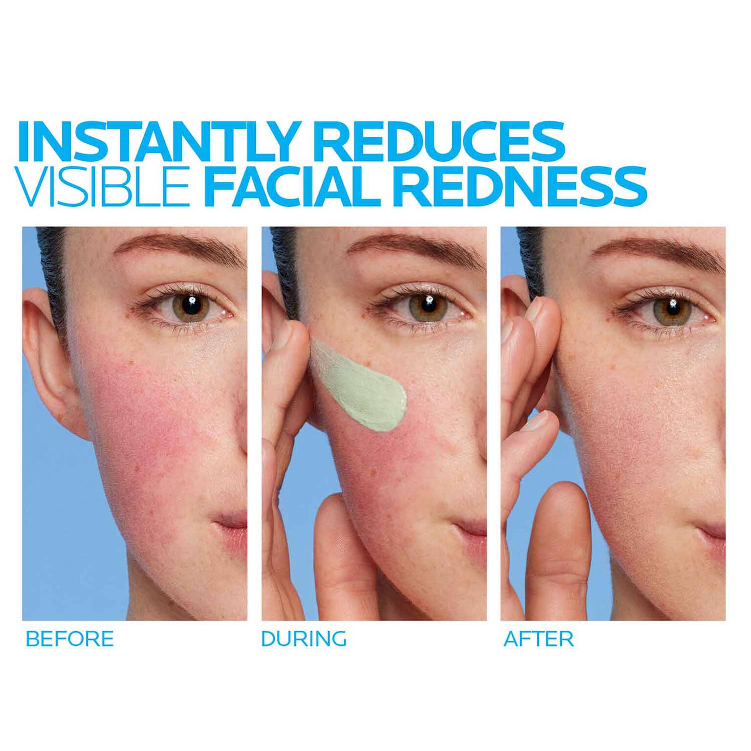 toleriane-rosaliac-ar-face-cream-for-visible-redness-v5 8_Toleriane_Rosaliac-AR-before-after.jpg