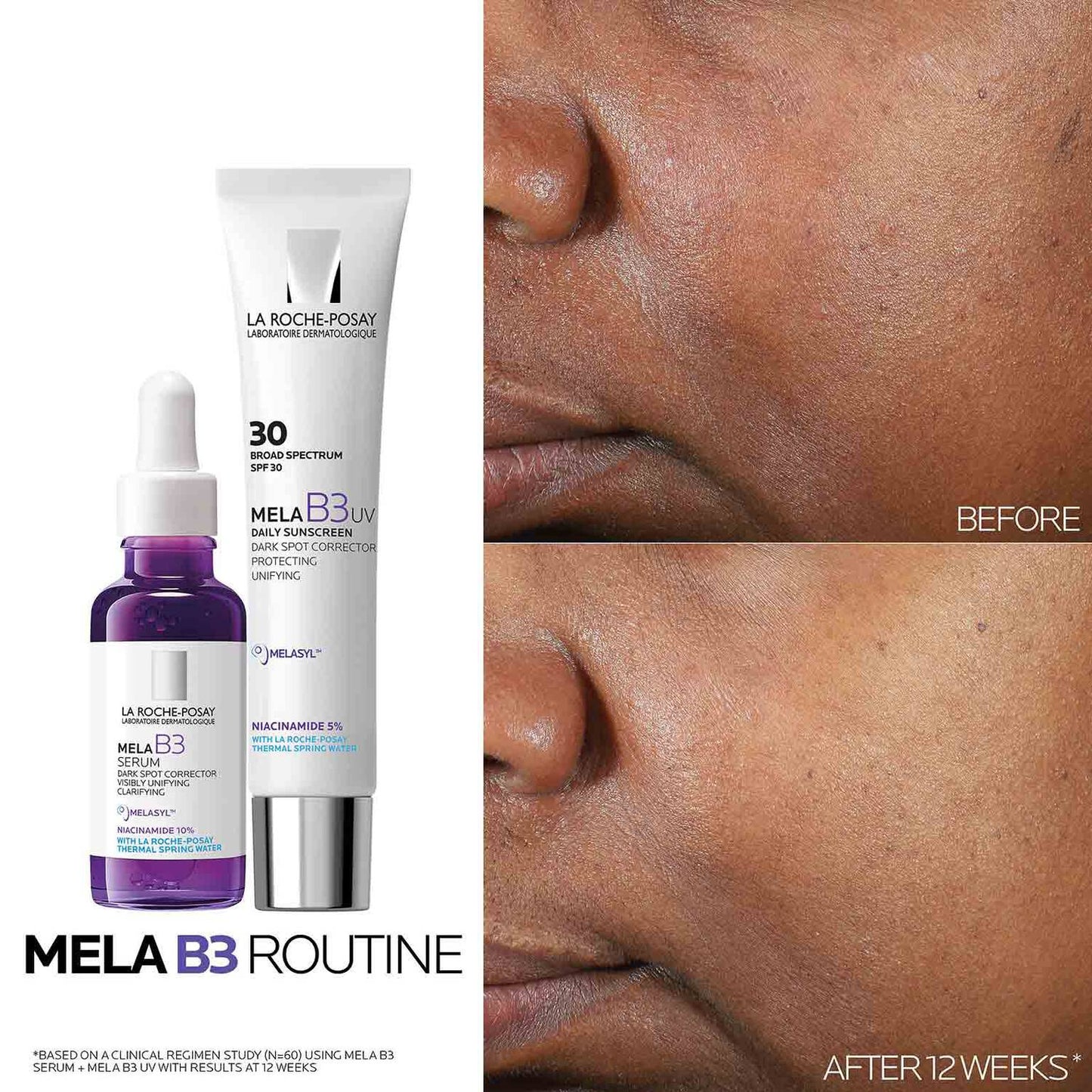 mela-b3-uv-daily-moisturizer-spf-30-with-melasyltm-niacinamide-r8 Mela-B3-routine_1500X1500.jpg
